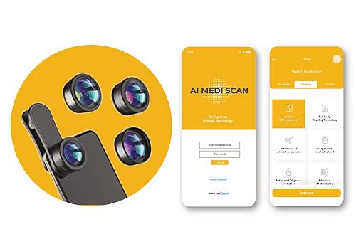 French Design Awards Winner - Accurate At-home Diagnosis of Skin Cancers by AI MEDI SCAN